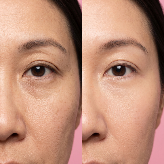Exception Rosée Regenerating Eye Patches